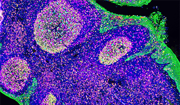 Automated Opal Multiplex IHC Detection Kits