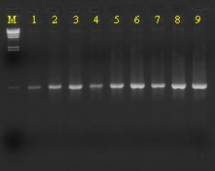 Taq DNA Polymerase