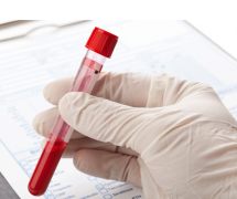 FineQuick Blood Genomic DNA Kit